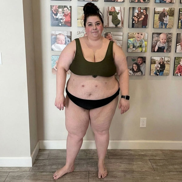 Before — Susan K.